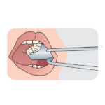 Bishop Cheek Retractor - Image 2